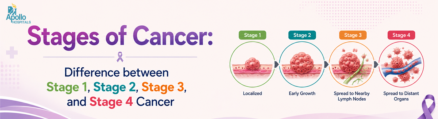 Stages of Cancer Explained | Stage 1 to Stage 4