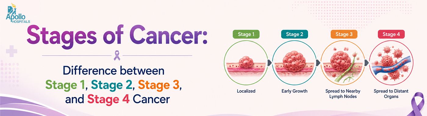 Stages of Cancer Explained | Stage 1 to Stage 4