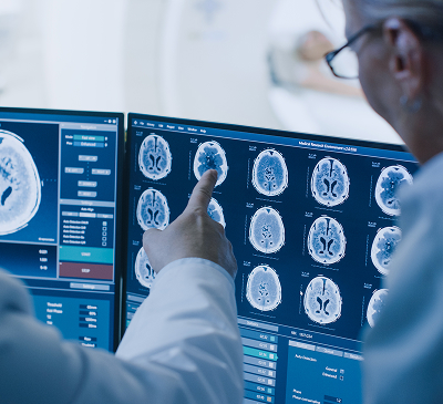 Brain Cancer thumbnail