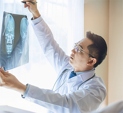Head And Neck Cancer thumbnail