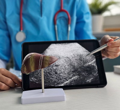 Liver Cancer thumbnail