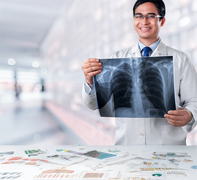 Lung Cancer thumbnail