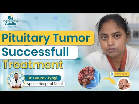 Pituitary Tumor Success Full Treatment: Patient Sujata Story | Apollo Hospital Delhi