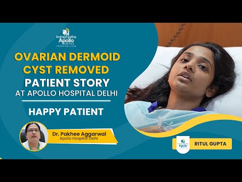  Ovarian Dermoid Cyst Removed Patient Story | Painless Ovarian Cyst Removal Surgery