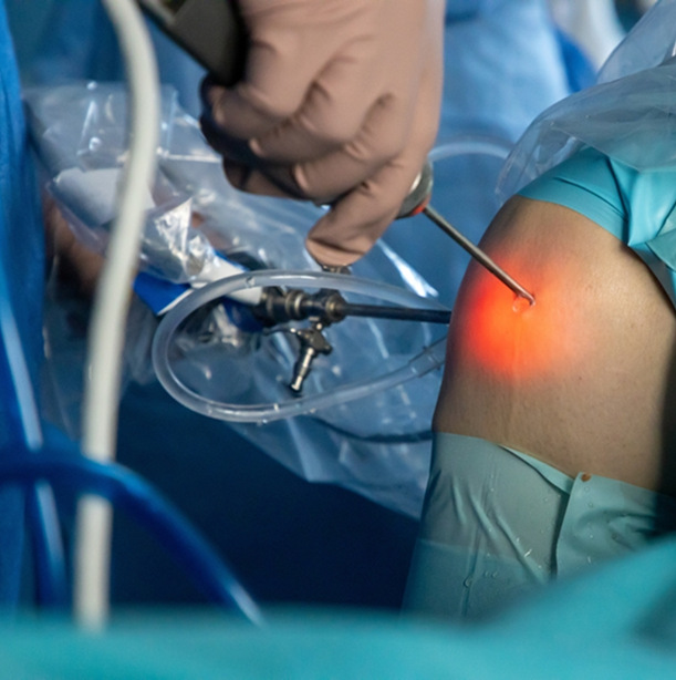Arthroscopic (Keyhole) Surgery