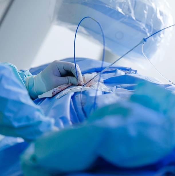 Cardiac and Vascular Surgery