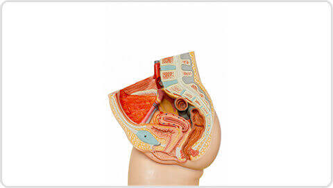 apollo-cervical-cancer