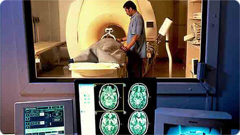 apollo-precise-diagnostic