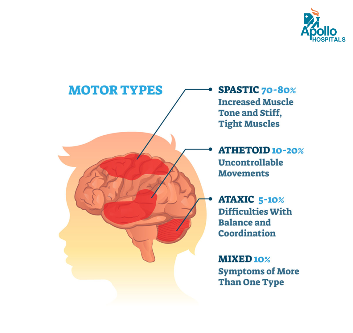 Types of Cerebral Palsy Motors