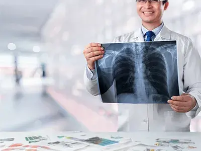 Lung Cancer thumbnail