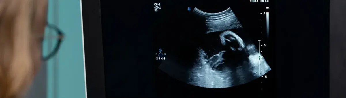 2d-echo-test-meaning