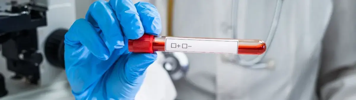 Adenosine Deaminase Test