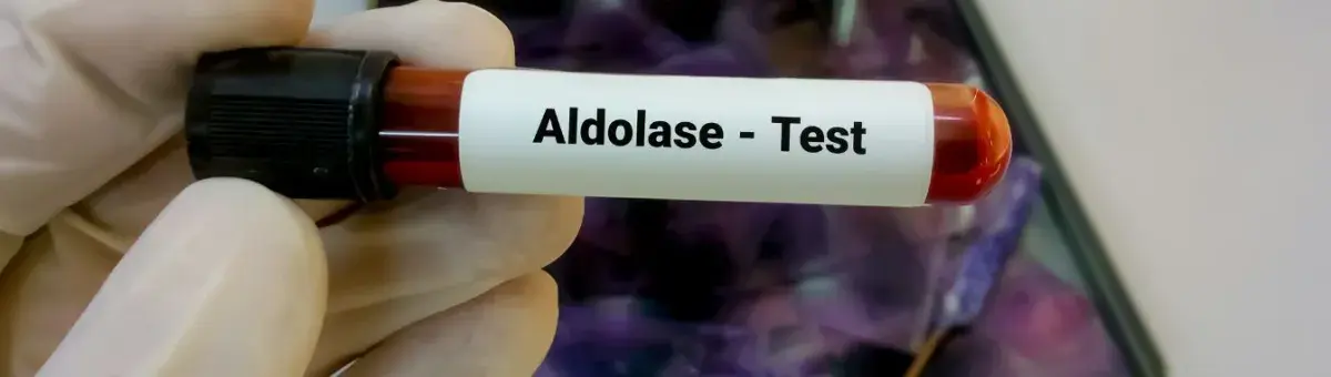 Aldolase Test