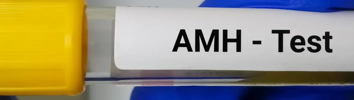 Anti-Mullerian Hormone Test