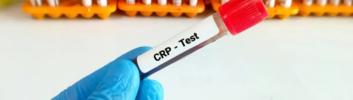 C-Reactive Protein Test