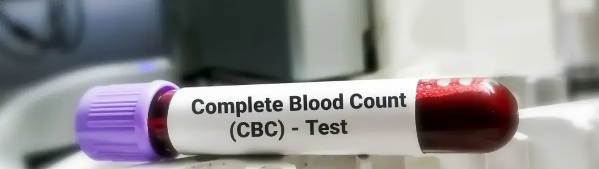 CBC Hemogram Test