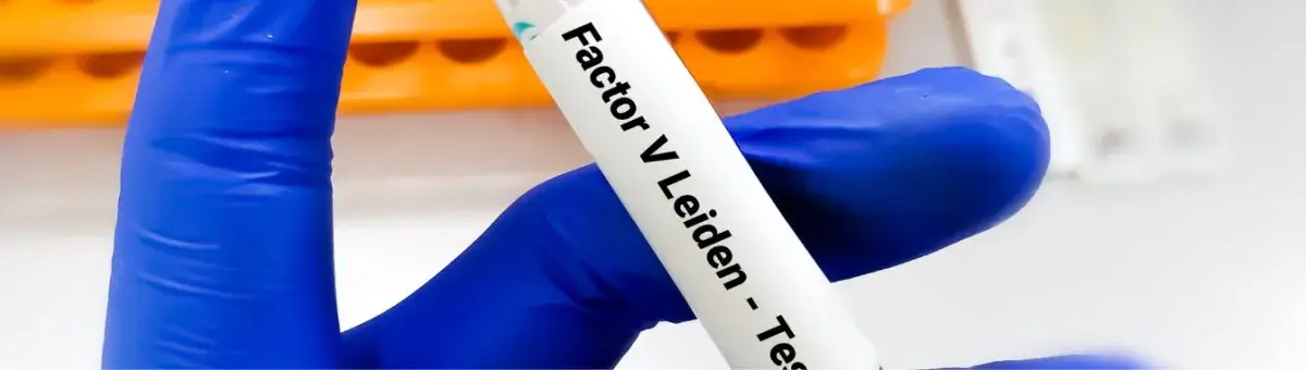 factor-v-leiden-test