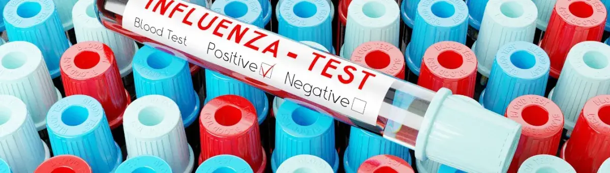 influenza test