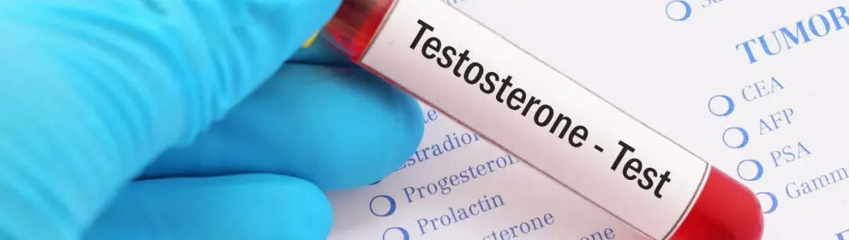 Mayeso a Testosterone