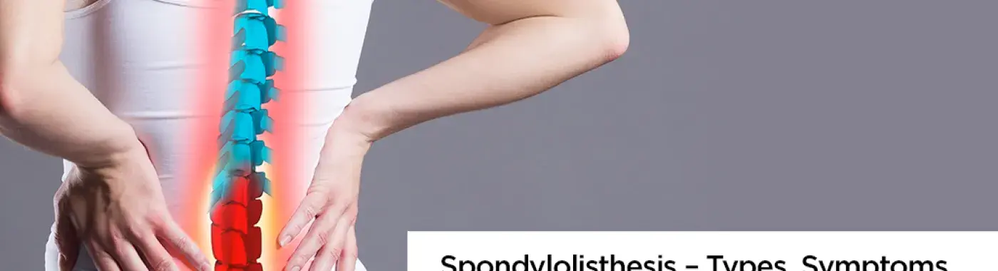 Spondylolisthesis – Types, Symptoms and Treatment