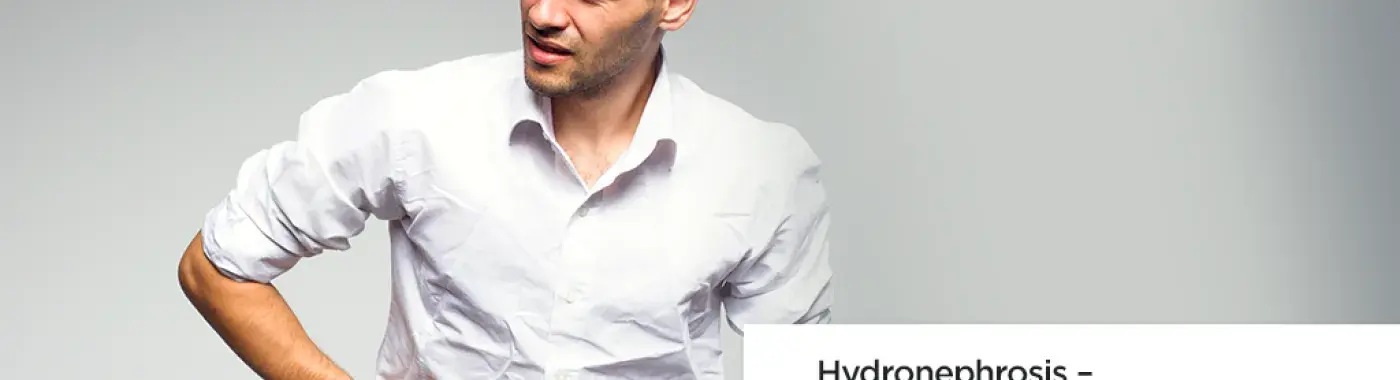 Hydronephrosis : Symptoms, Causes &amp; Treatment
