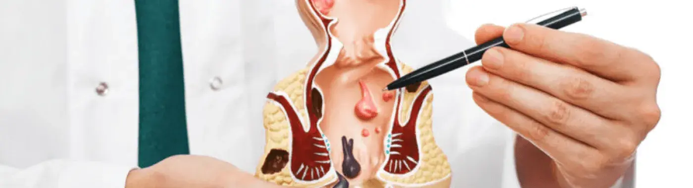 Semua yang Anda Perlu Tahu Mengenai Abses Dubur