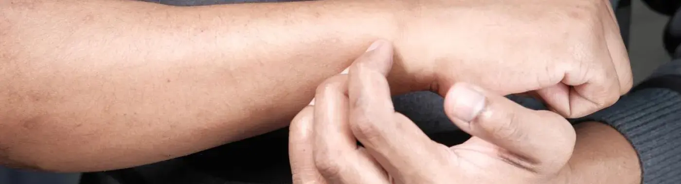 Asterixis: Causes, Symptoms, Treatment, Diagnosis, Risk Factors