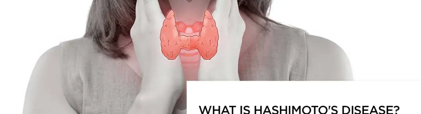What is Hashimoto’s disease?