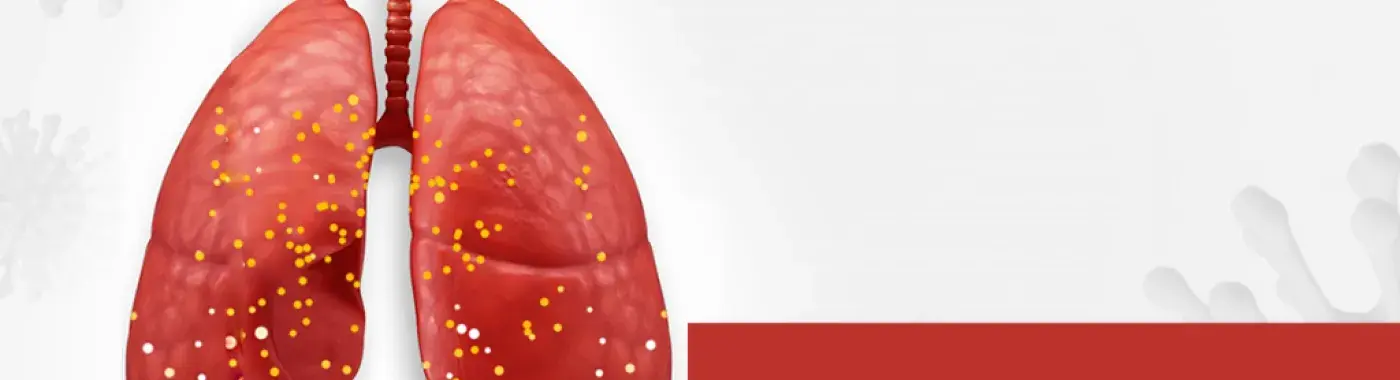 Cytokine Storm – An Overview