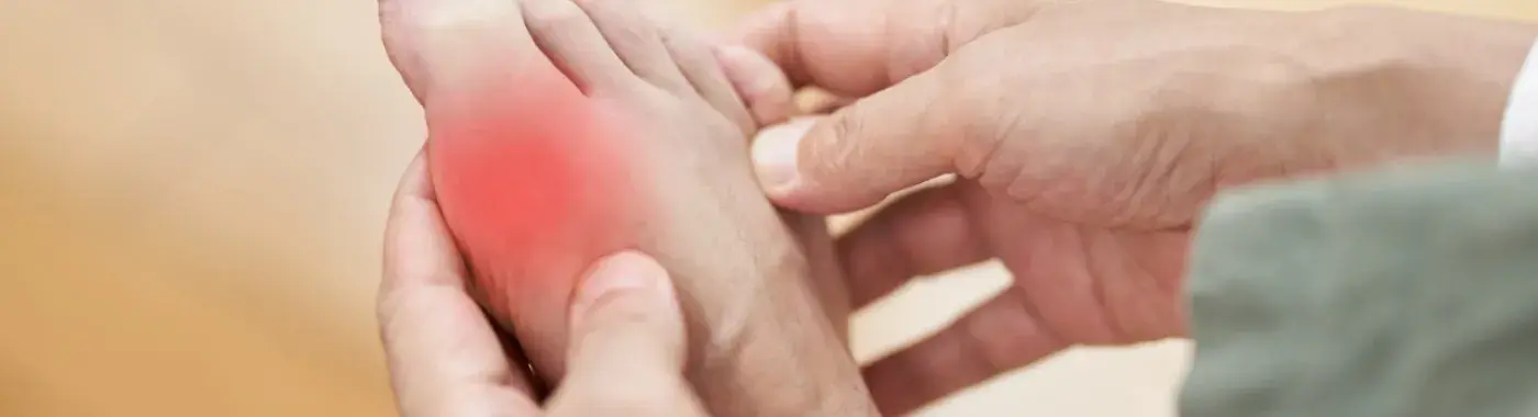 Hyperuricemia – Symptoms, Causes, Diagnosis and Treatment