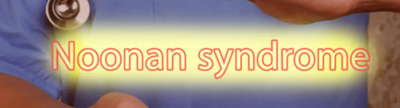 Noonan Syndrome – Causes Symptoms And Treatment