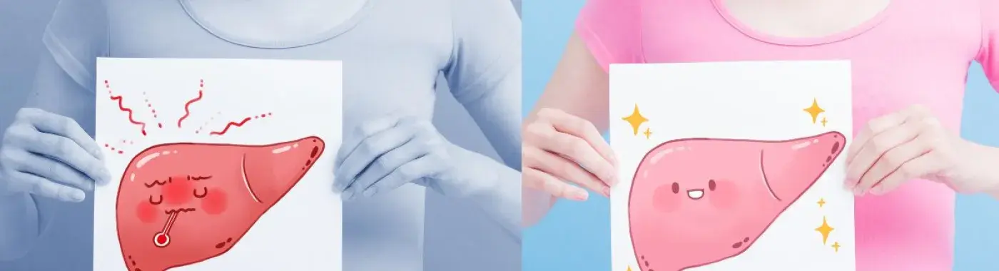 Primary Sclerosing Cholangitis – Causes, Symptoms and Treatment