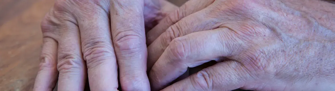 Psoriatic Arthritis: Types Symptoms Causes and Treatments