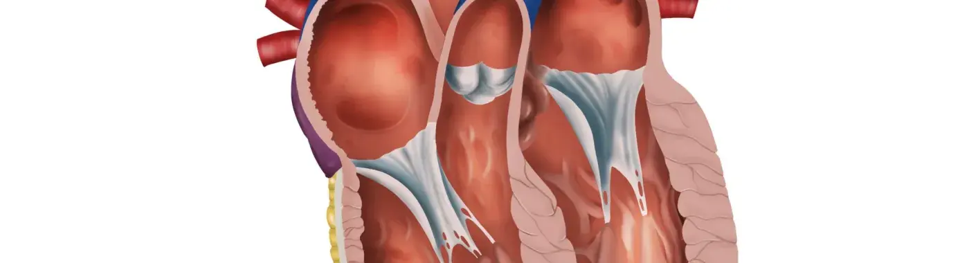 Pulmonary Valve Disease – Causes, Symptoms and Treatment