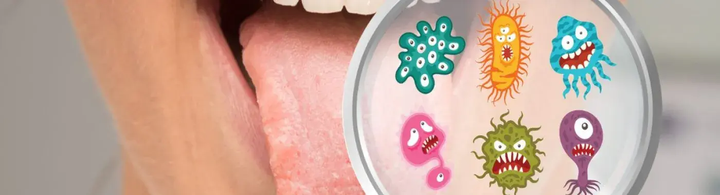 Soft Palate Cancer- Causes, Symptoms and Treatment