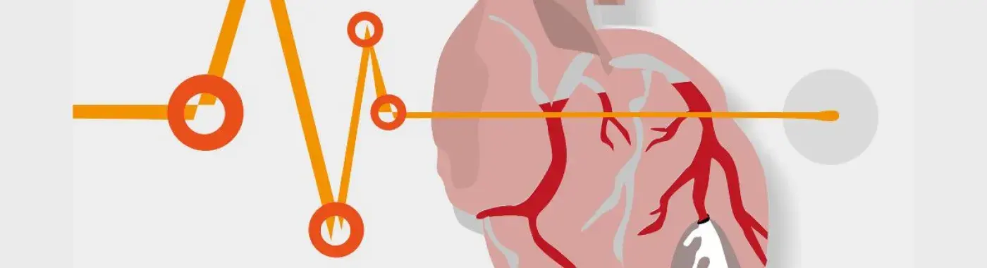 Don’t Underestimate the Risk: The Truth About Sudden Cardiac Arrest in Young People