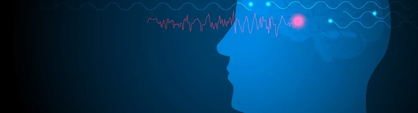 Temporal Lobe Seizure