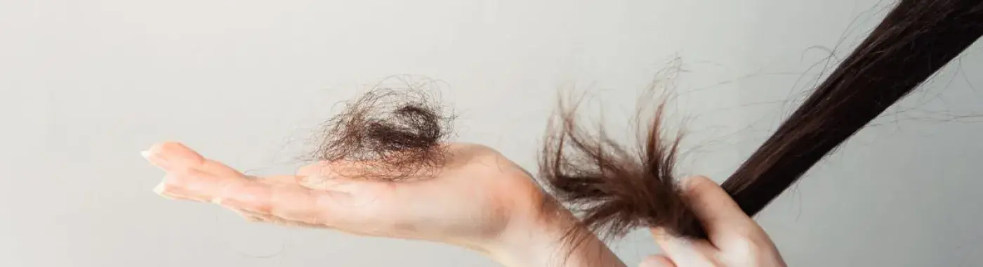 Trichotillomania (Hair Pulling Disorder)- Treatment, Causes and Symptoms