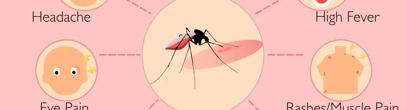 What causes dengue and its common symptoms?