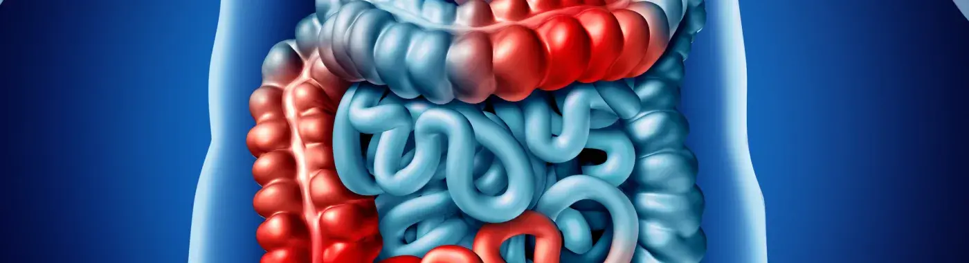 Intestinal Obstruction – Factors, Types and Treatment