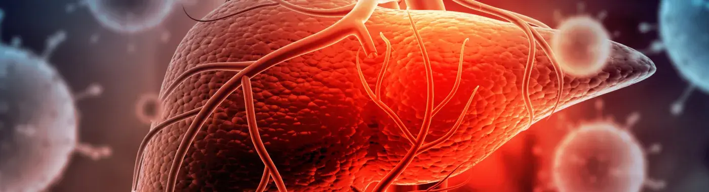 Hepatitis A: Symptoms, Causes, Prevention