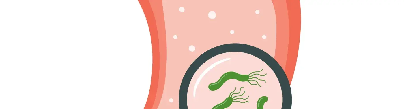 What Is Antral Gastritis? – Treatments and Symptoms