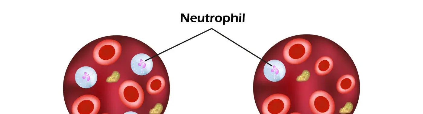 Neutropenia