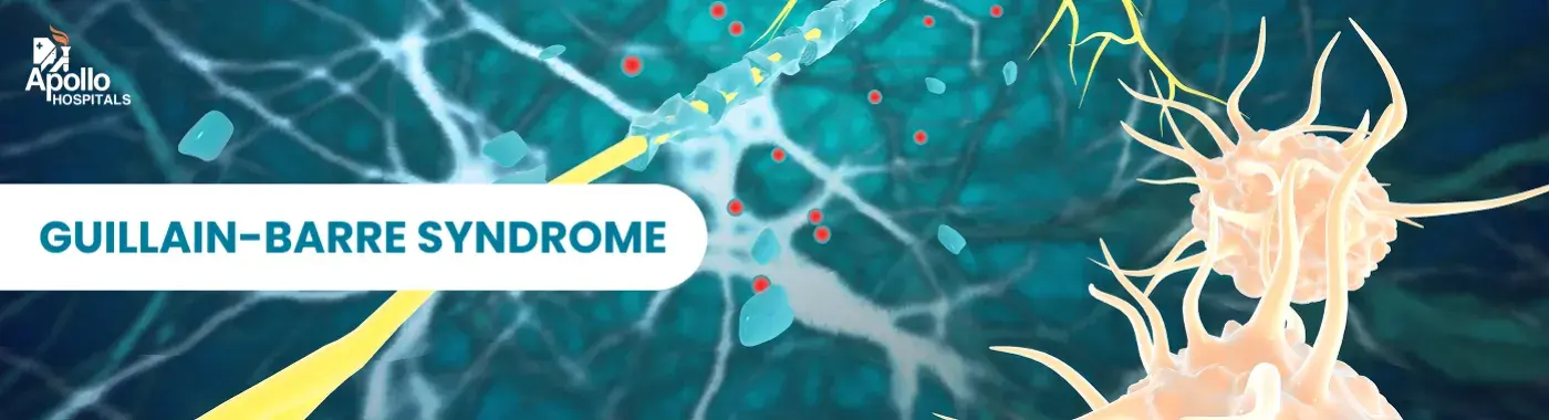 Guillain-Barré Syndrome (GBS)