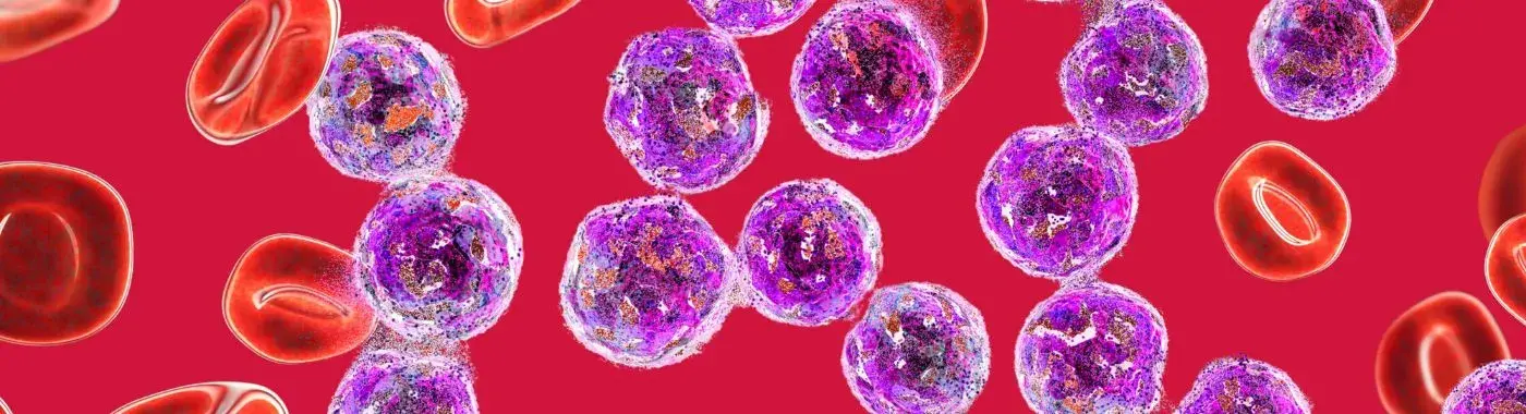 Abetalipoproteinemia - Causes, Symptoms, Diagnosis, Treatment, and Prevention