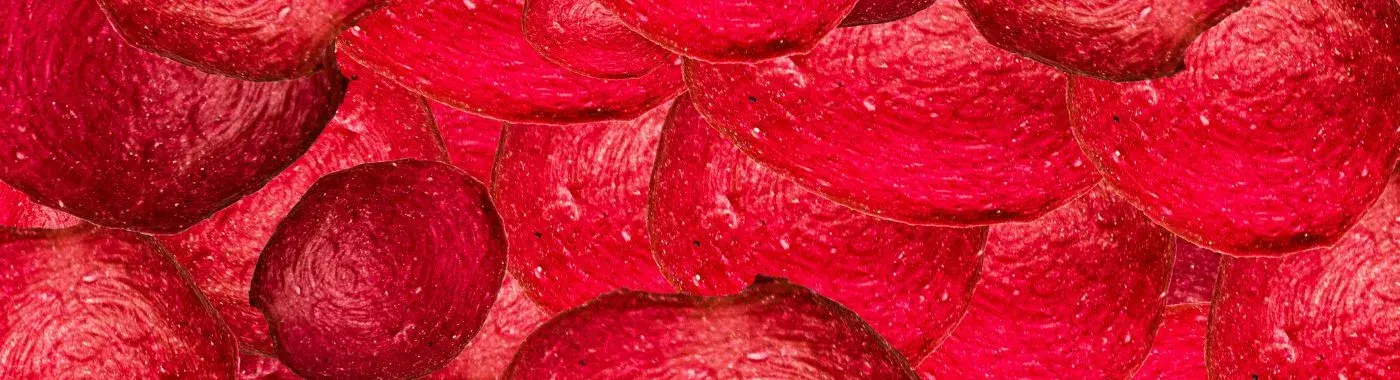 Antiphospholipid Syndrome - Causes, Symptoms, Diagnosis, Treatment, and Prevention