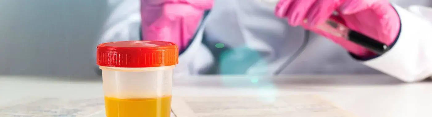 Asymptomatic Bacteriuria - Causes, Symptoms, Diagnosis, Treatment, and Prevention