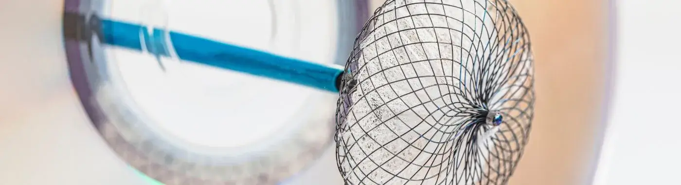 Atrial Septal Defect