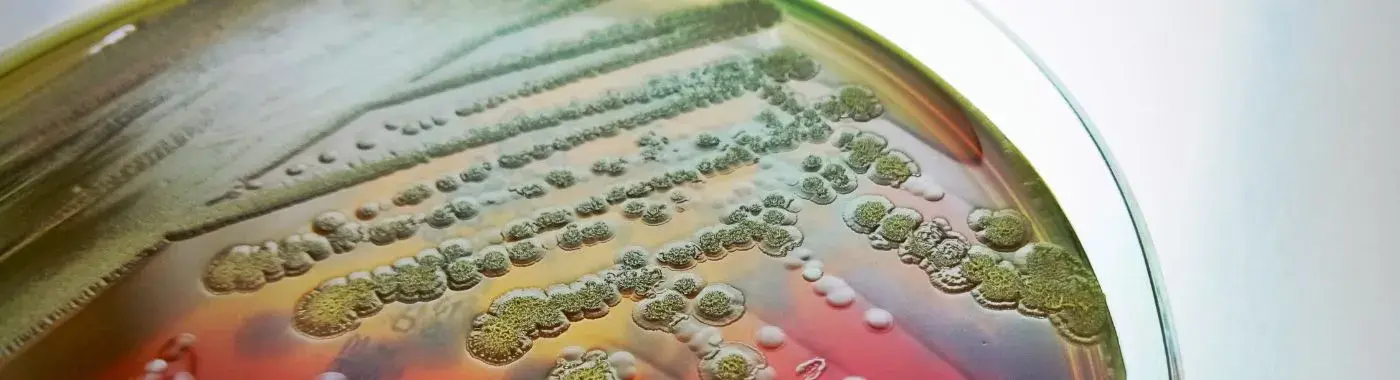 Bacteremia - Causes, Symptoms, Diagnosis, Treatment, and Prevention