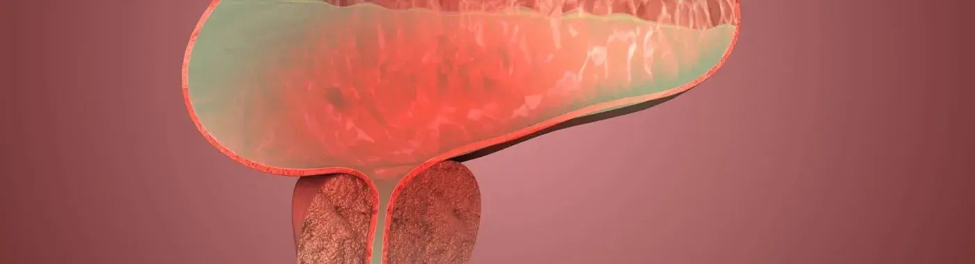 Benign Tumor - Causes, Symptoms, Diagnosis, Treatment, and Prevention